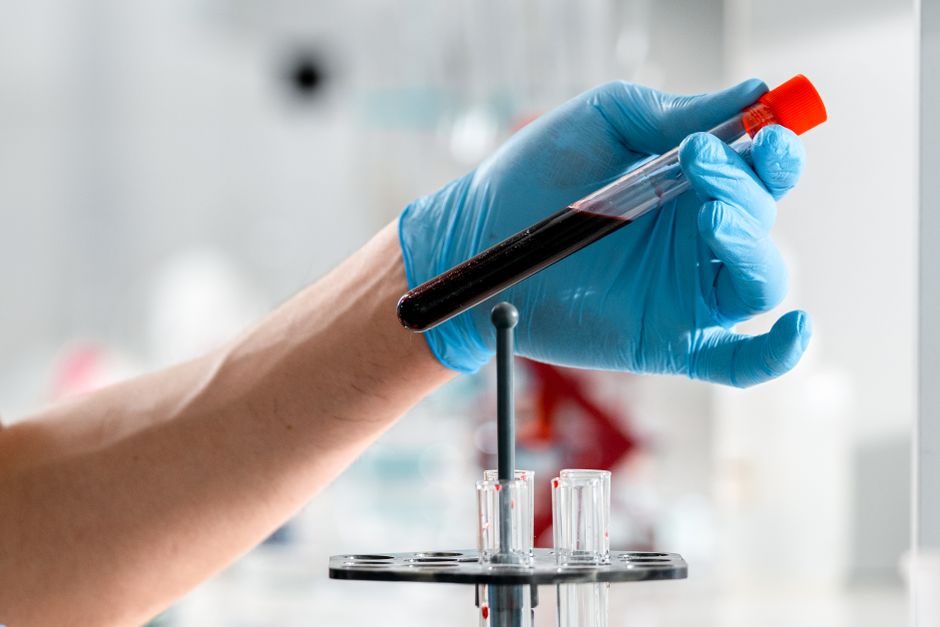 Pruebas médicas de laboratorio en Castilla-La Mancha
